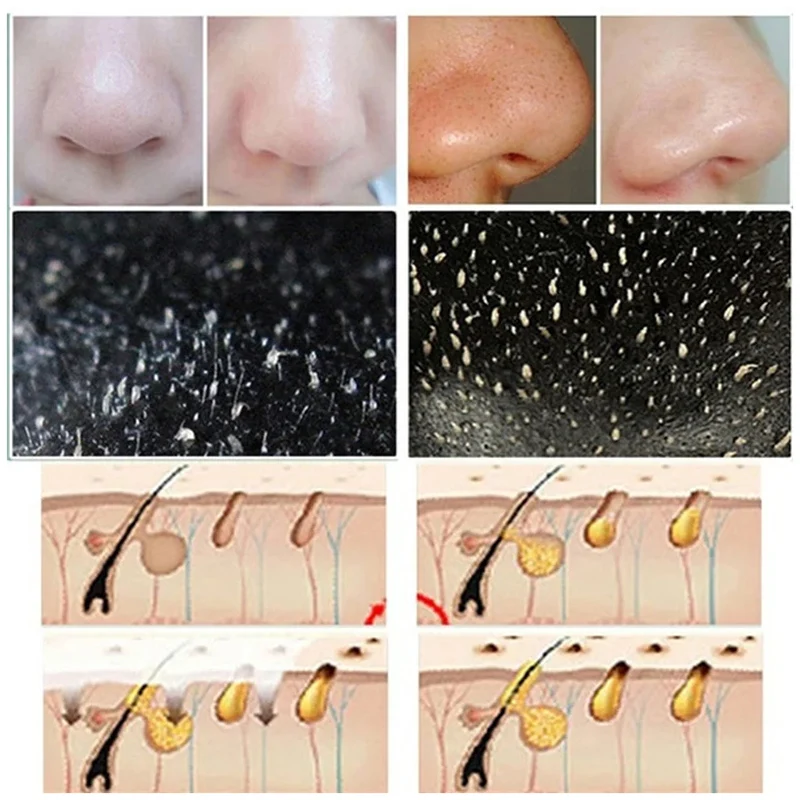 10pcs Blackhead Nose Strips De - Cleanser Face recension och pris