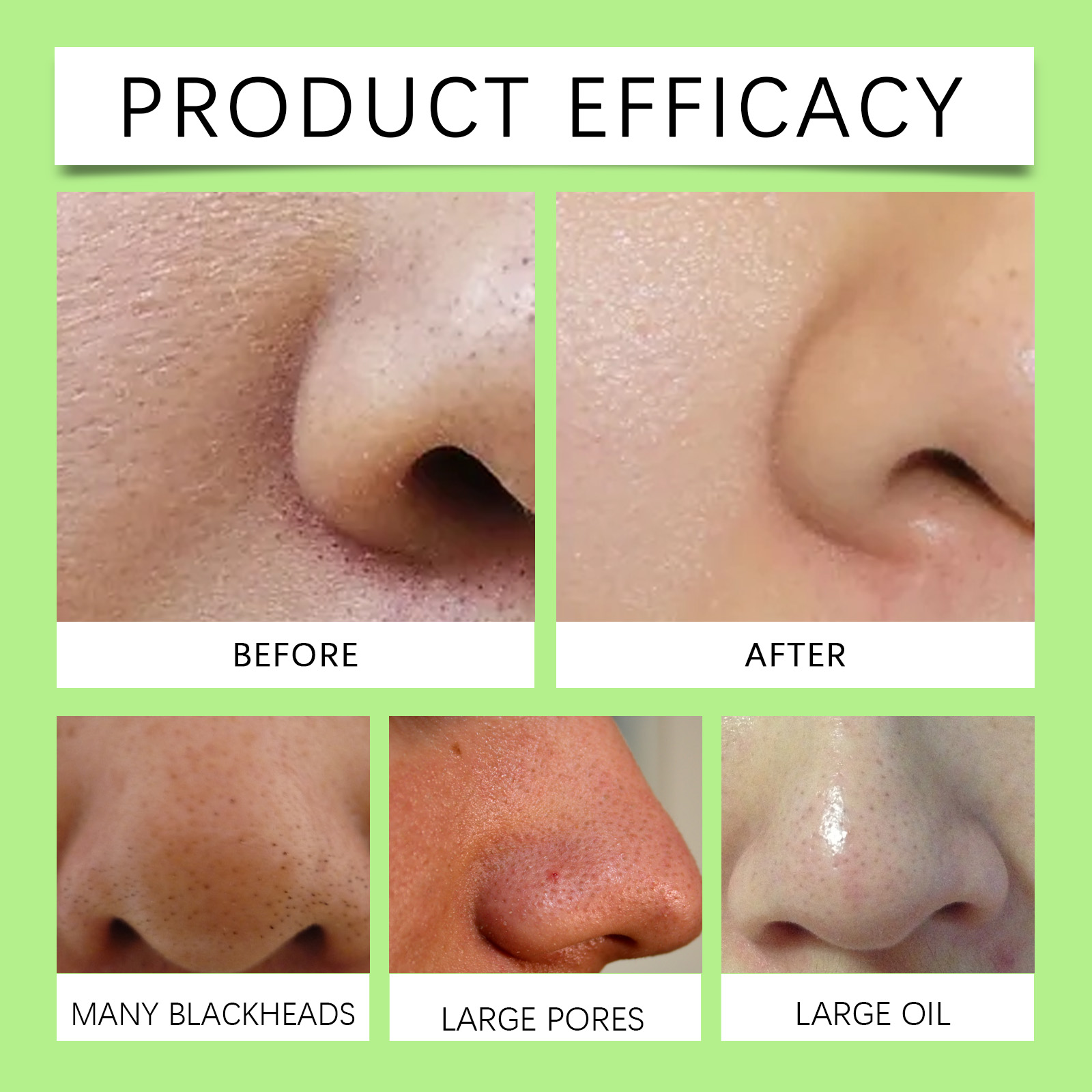 Bamboo Charcoal Nose Strips fo - Cleanser Face recension och pris