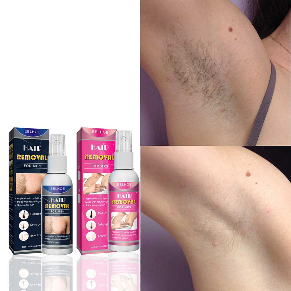 1/2PCS Super Natural Painless  - Body Lotion recension och pris